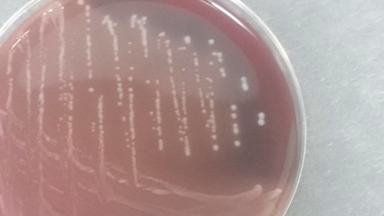 Are lactobacilli in blood cultures a clinical significance?