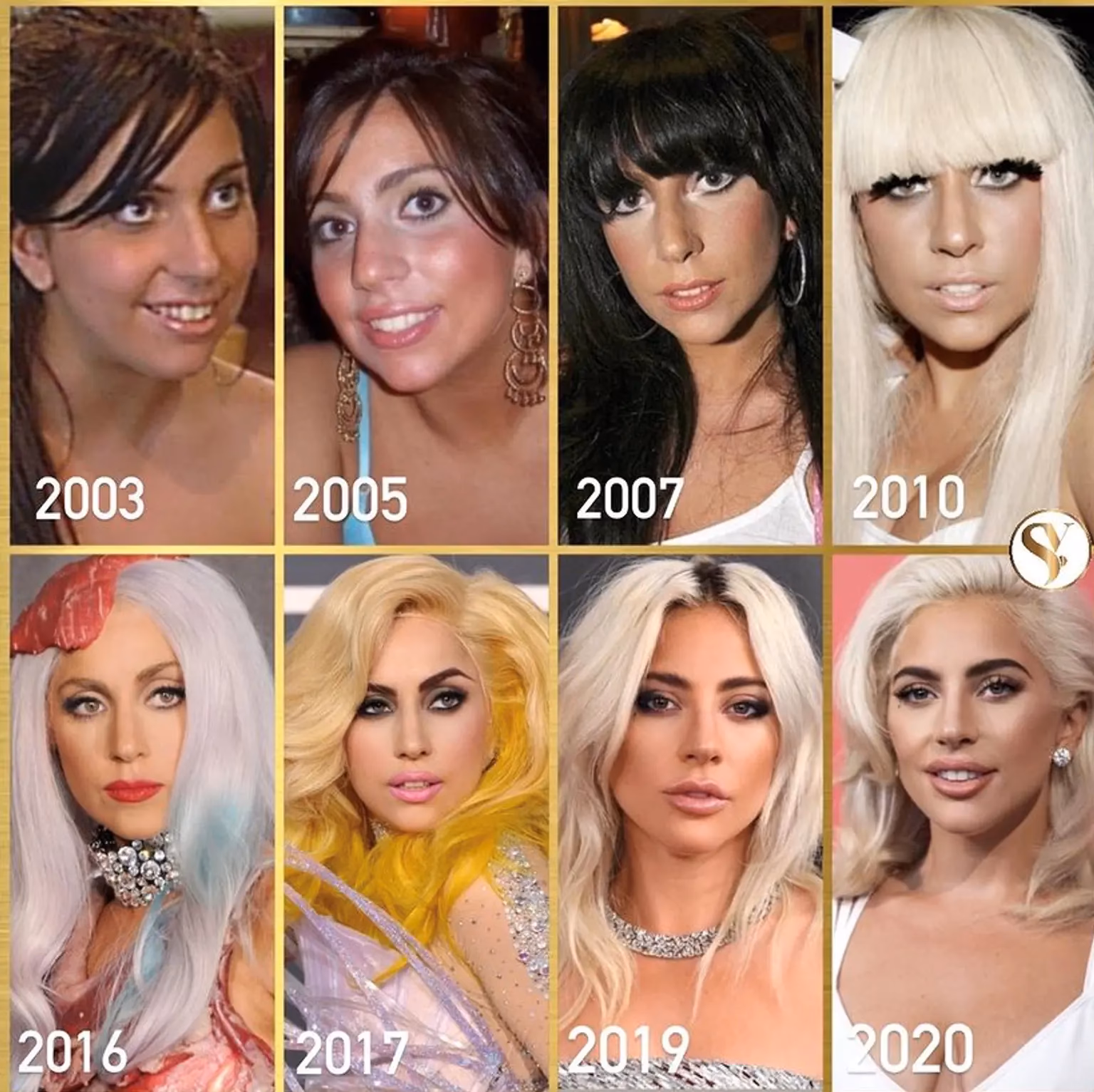 Did Lady Gaga have a rhinoplasty?