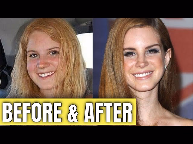 Did Lana have a nose job?
