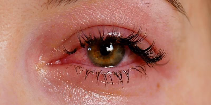 Are lash extensions allergic?