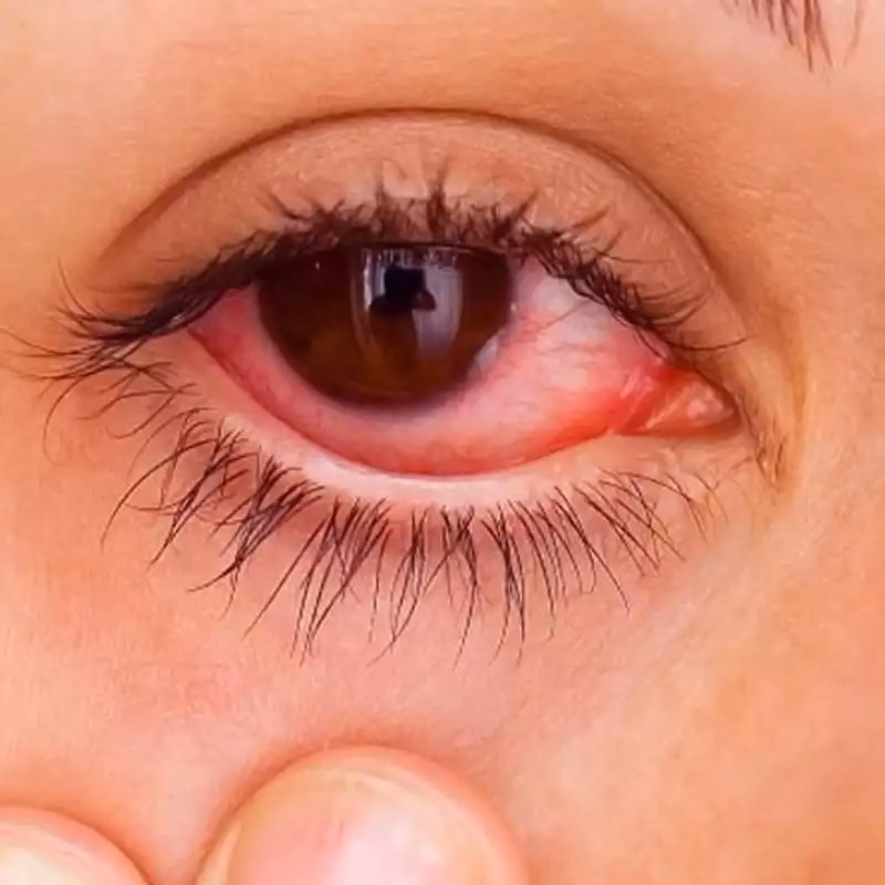 How do I know if I have an eyelash glue allergy?