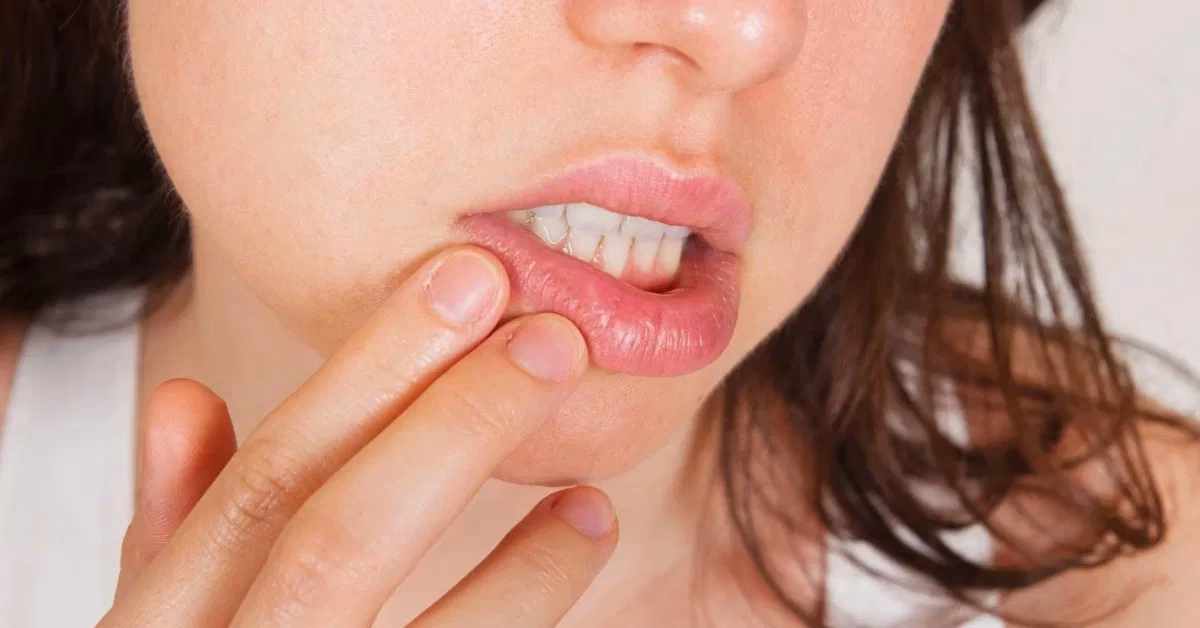 Can you get a lemon allergy from a tree?