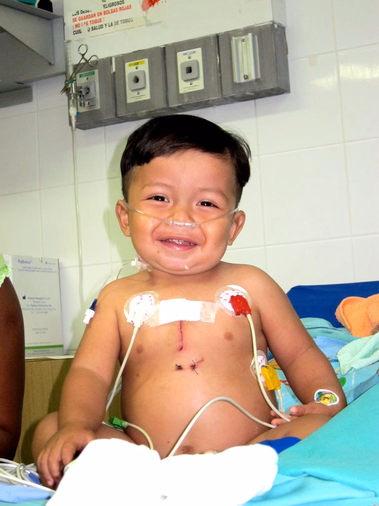 Are nurses a good resource if a baby has open heart surgery?