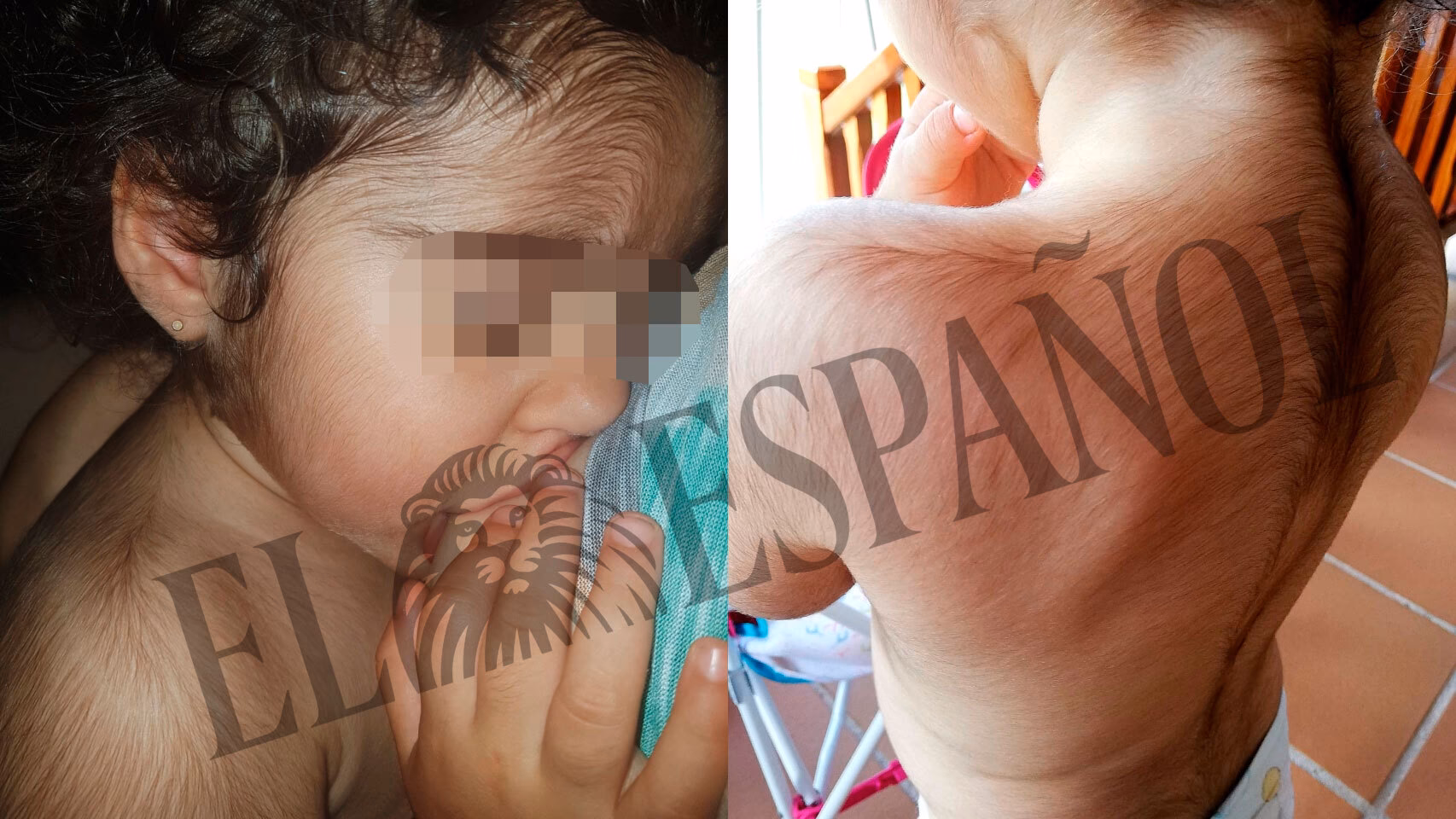 ¿Cuáles son las causas de caída de pelo en los niños?