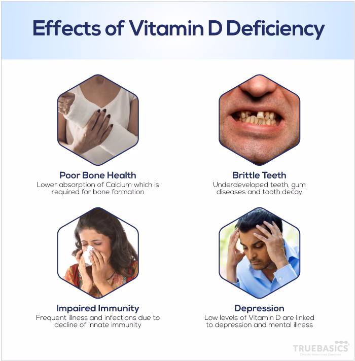Does vitamin D deficiency cause tonsillitis?