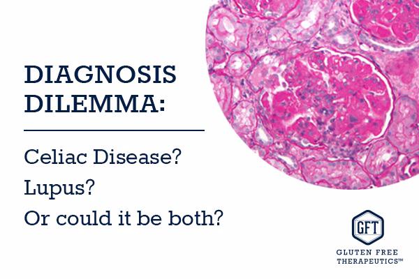 Can a gluten free diet help lupus?
