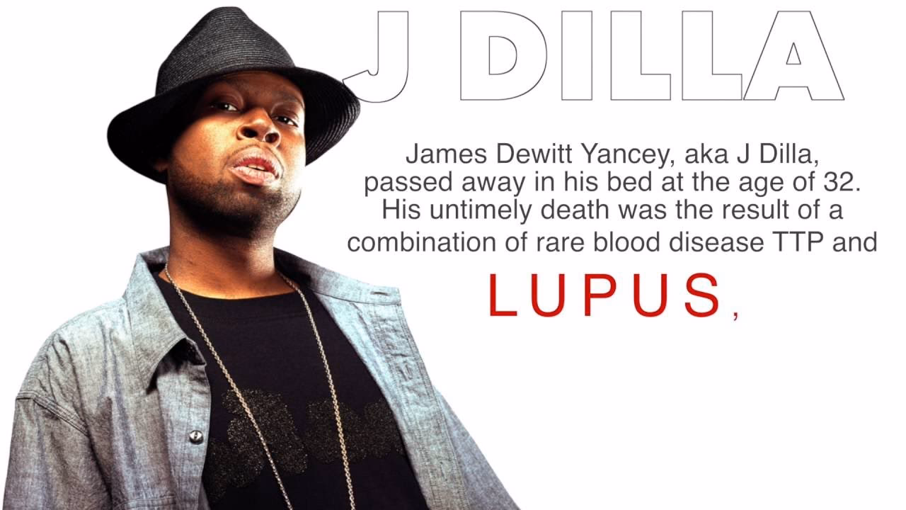 What is drug-induced lupus (Dil)?