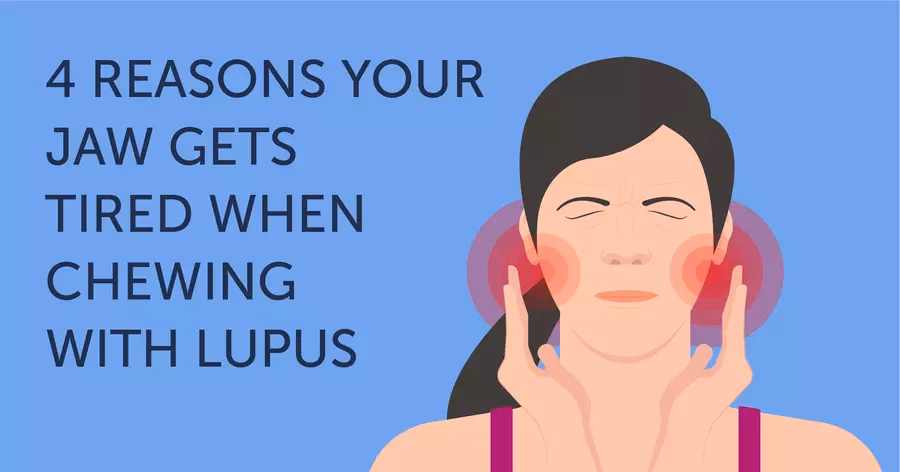 Can lupus cause tooth decay?