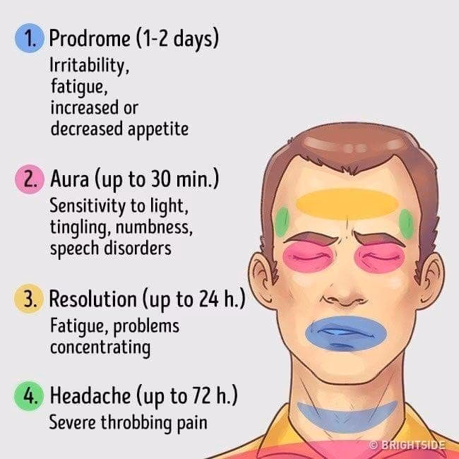 Does lupus cause migraines?
