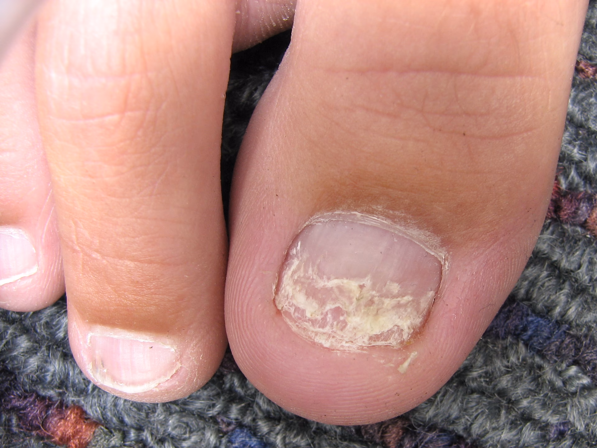 What does lupus look like?