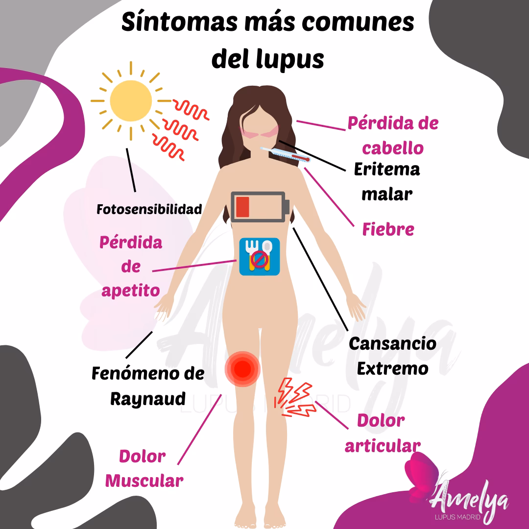 ¿Qué es el lupus y para qué sirve?