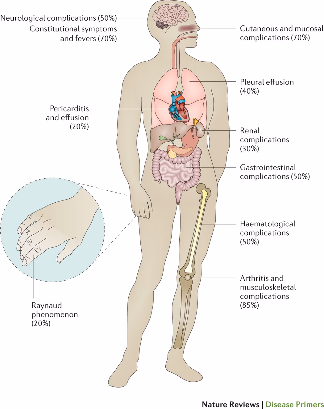 What is new in systemic lupus erythematosus research?