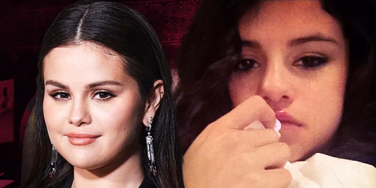 What are vocal changes in lupus?