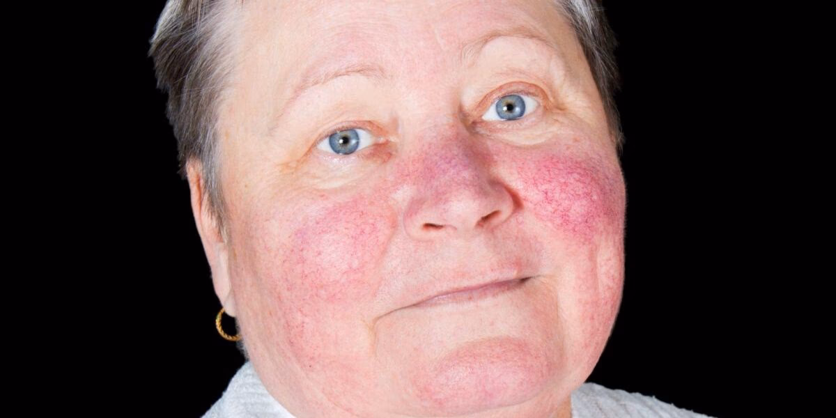 ¿Qué es la leucemia?