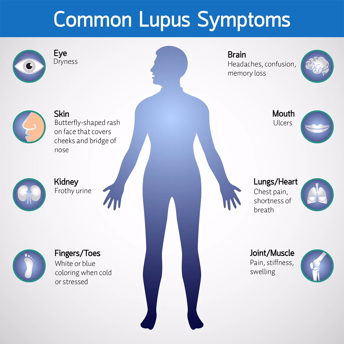 What should I do if I have lupus?
