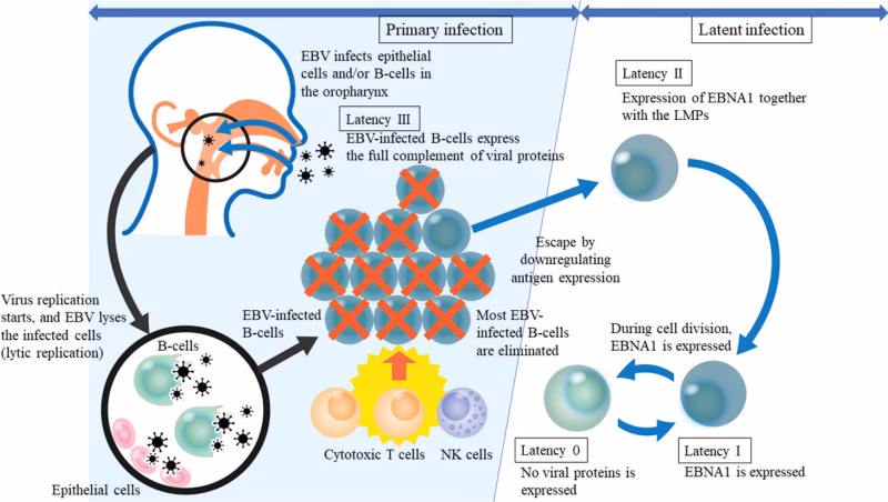 Does EBV establish latency upon B cell infection?
