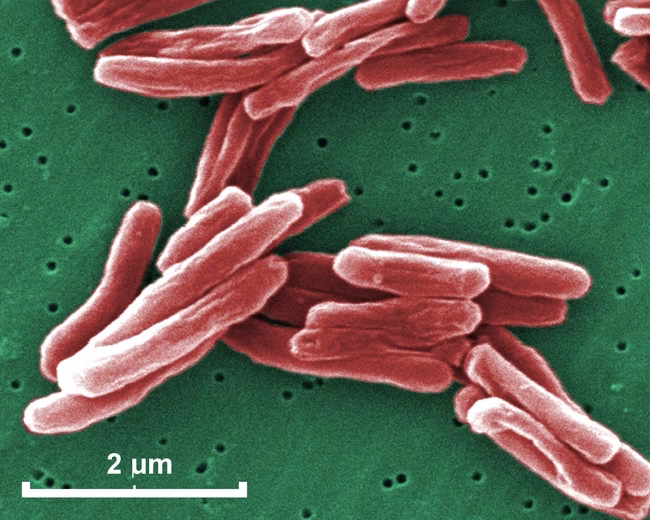 How many genes does M tuberculosis have?
