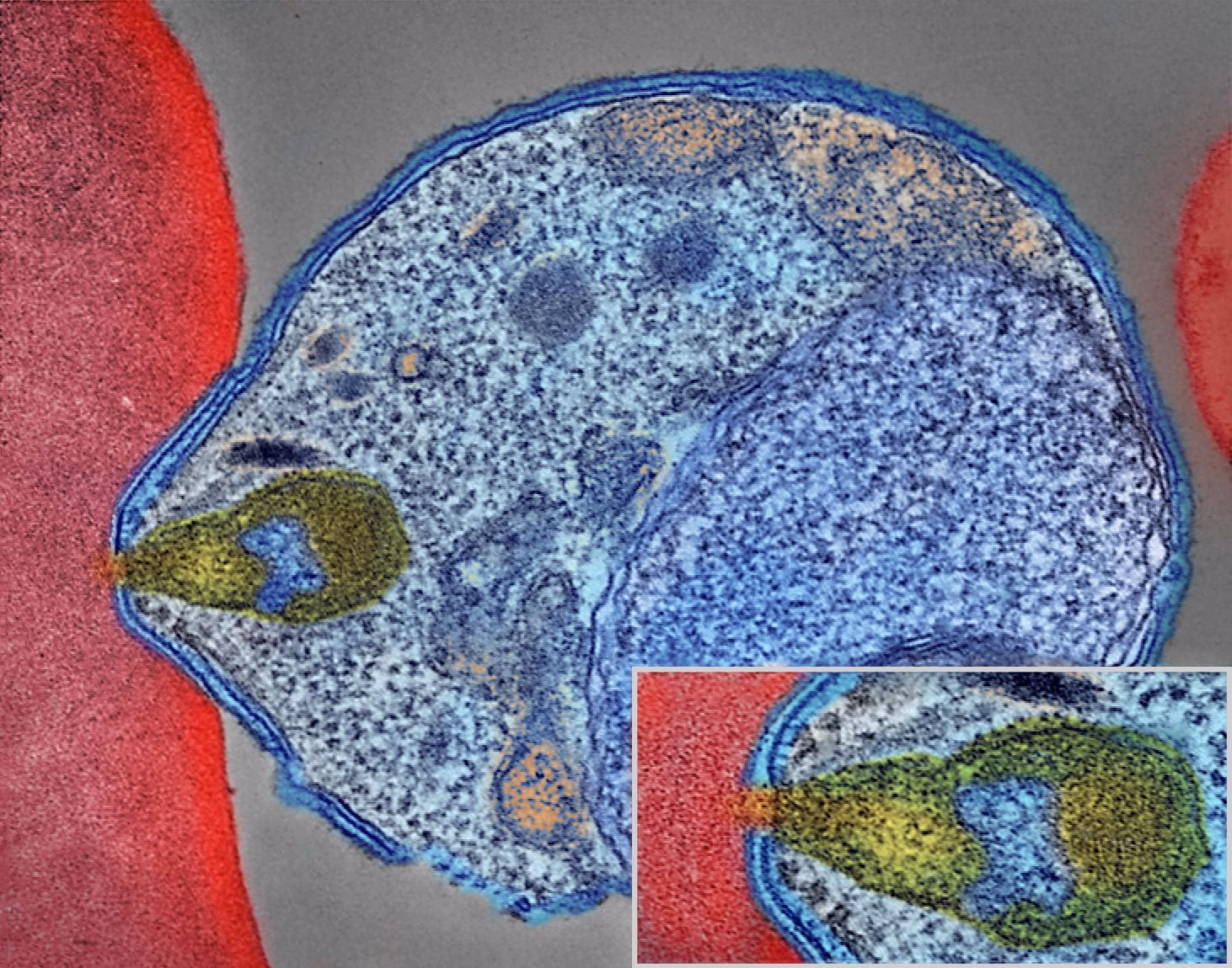 How many types of malaria are there?