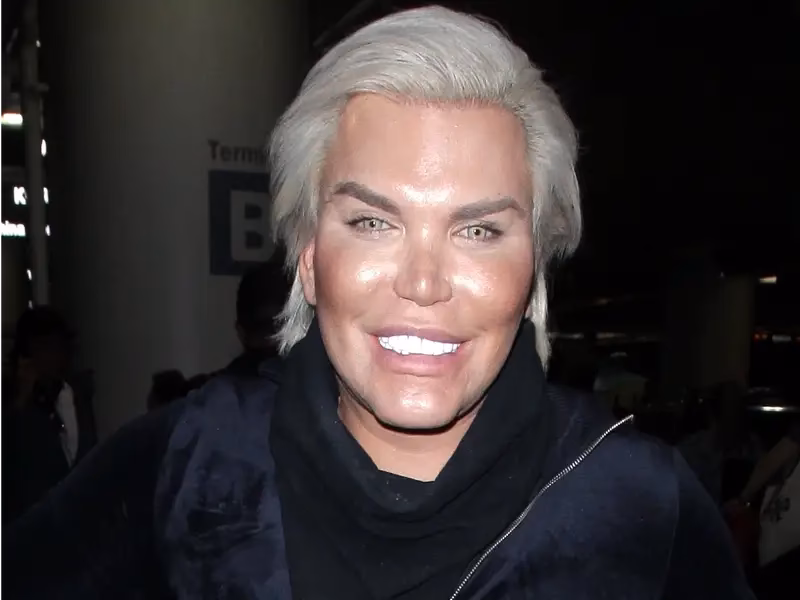 How many face transplants have been done?