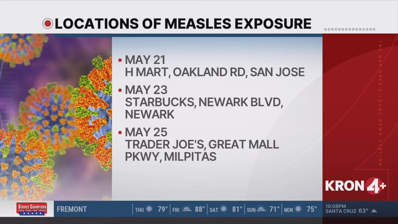 Is measles contagious?