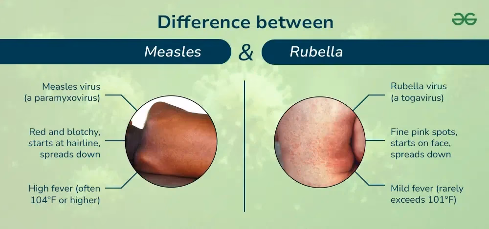 What diseases can cause measles?