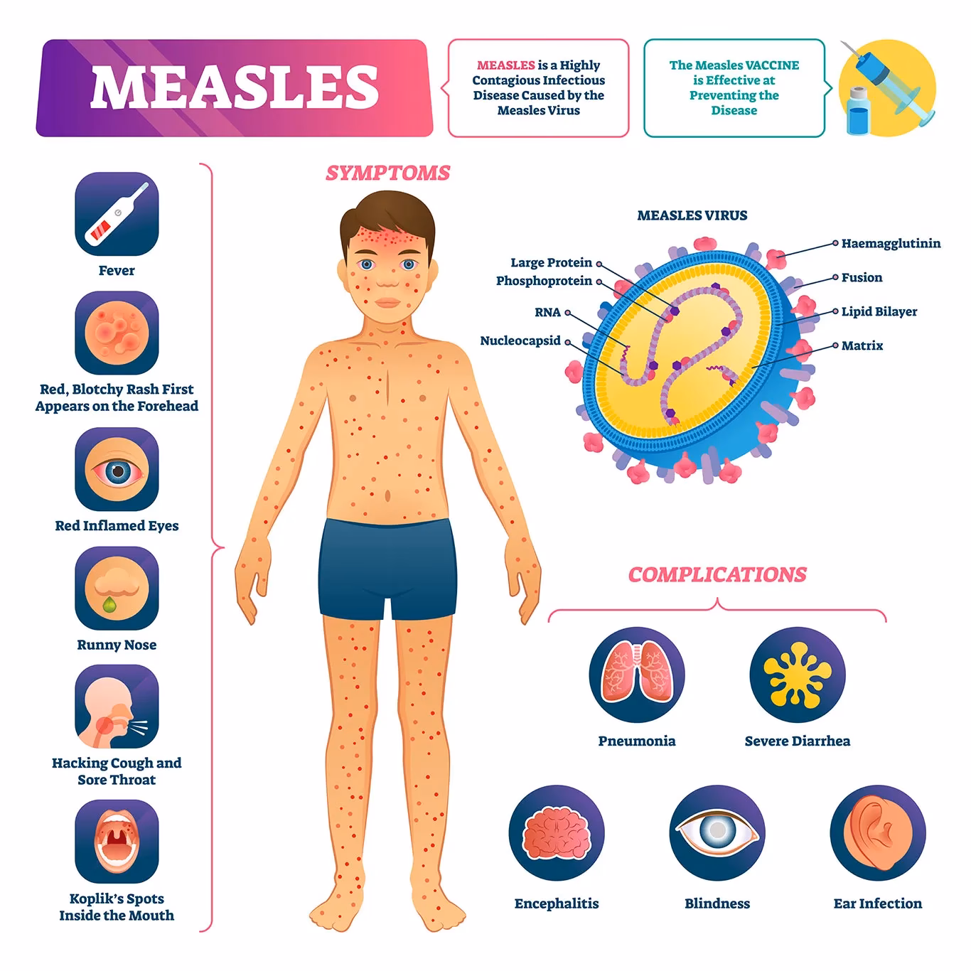 What are the symptoms of measles?