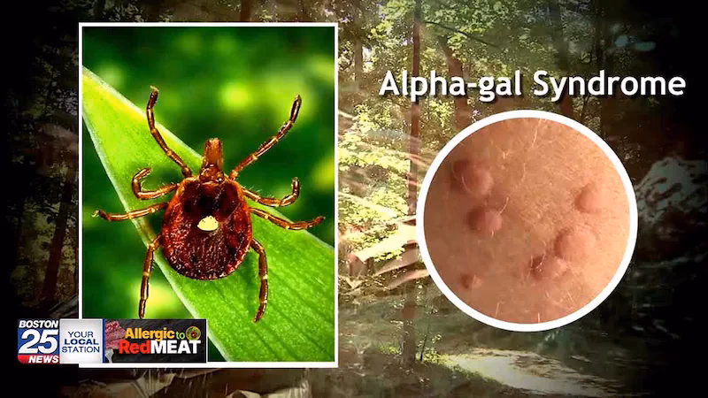 What is red meat allergy & tick-bite allergy?