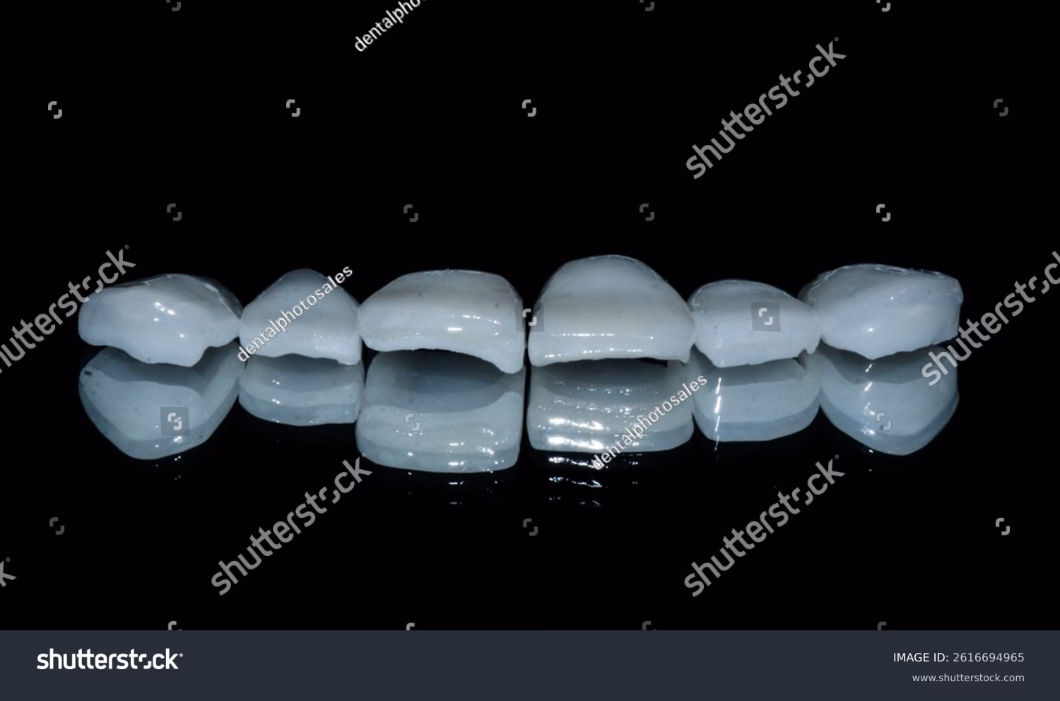 What is the Emax model?