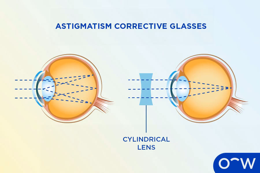 Can I get clear vision if I have astigmatism?