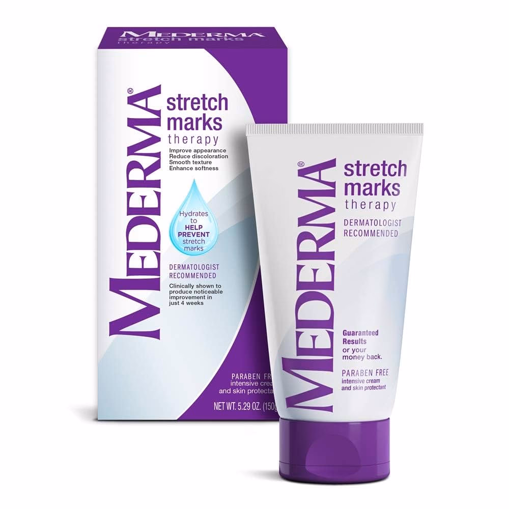 What are the treatment options for stretch marks (striae)?