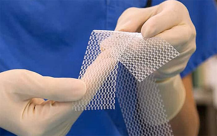 Did you know 93% of patients have heard of surgical mesh?