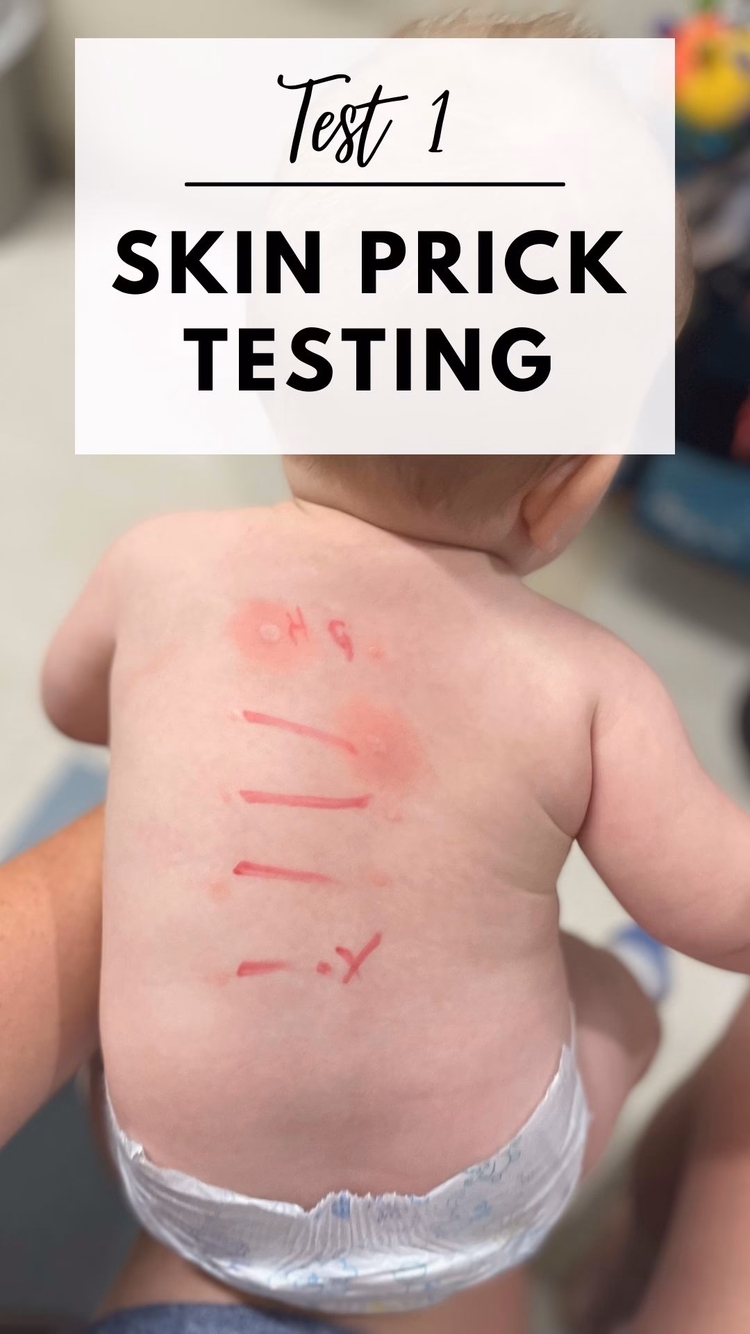 How do I know if my child has an allergy?