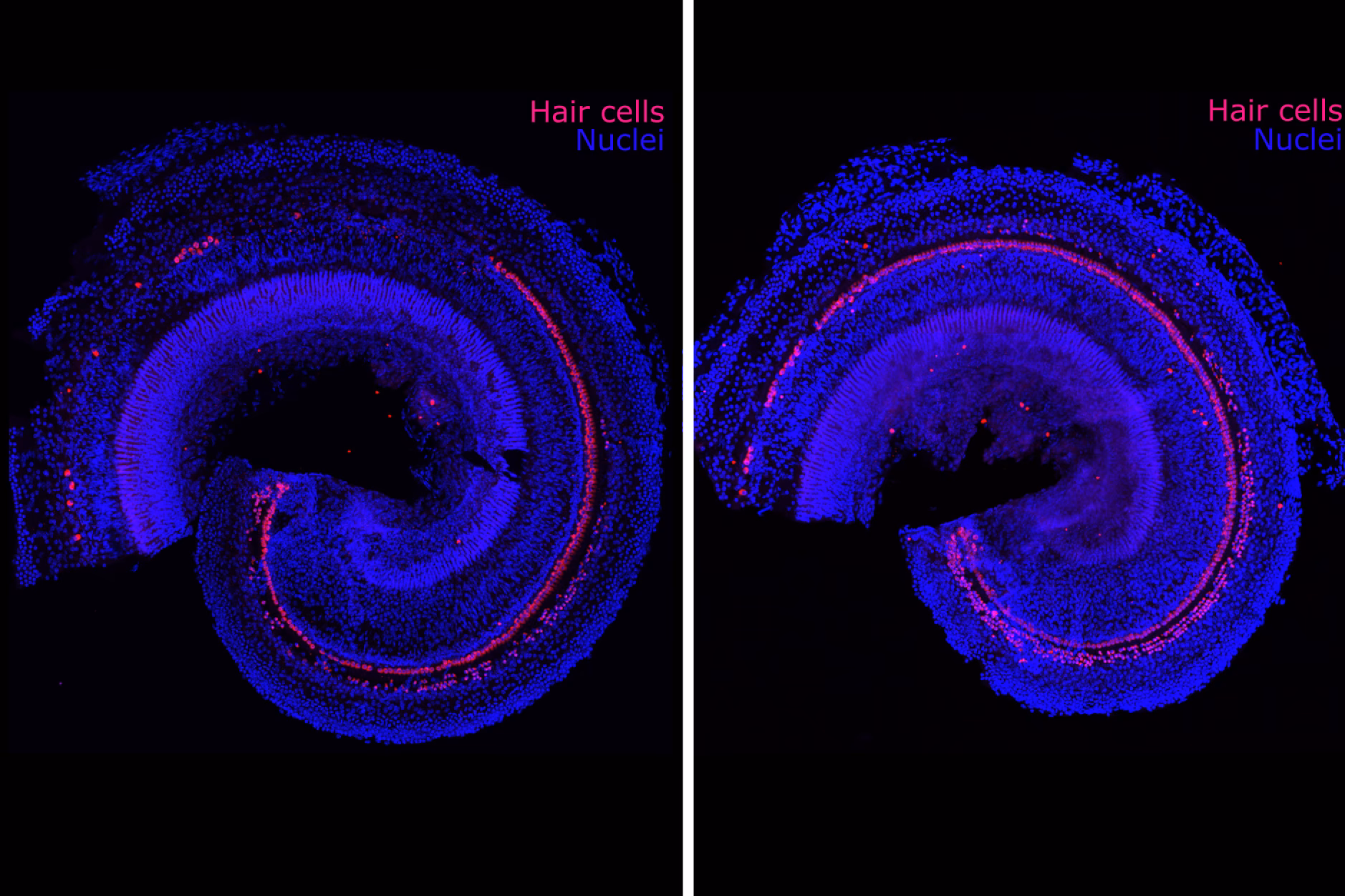 Could a chemical reprogramming technique reverse aging?