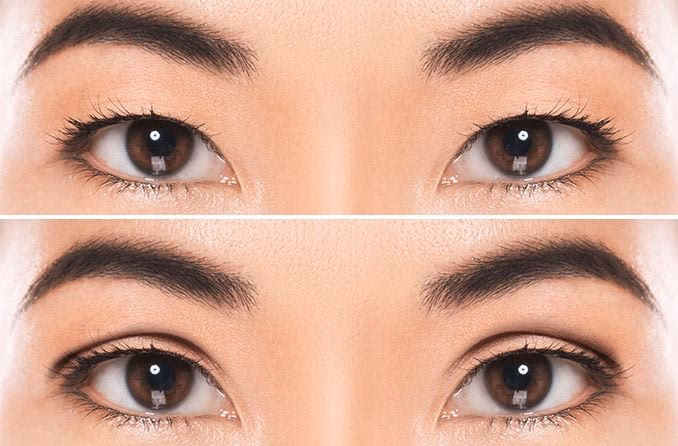 Do you have double eyelids or monolids?