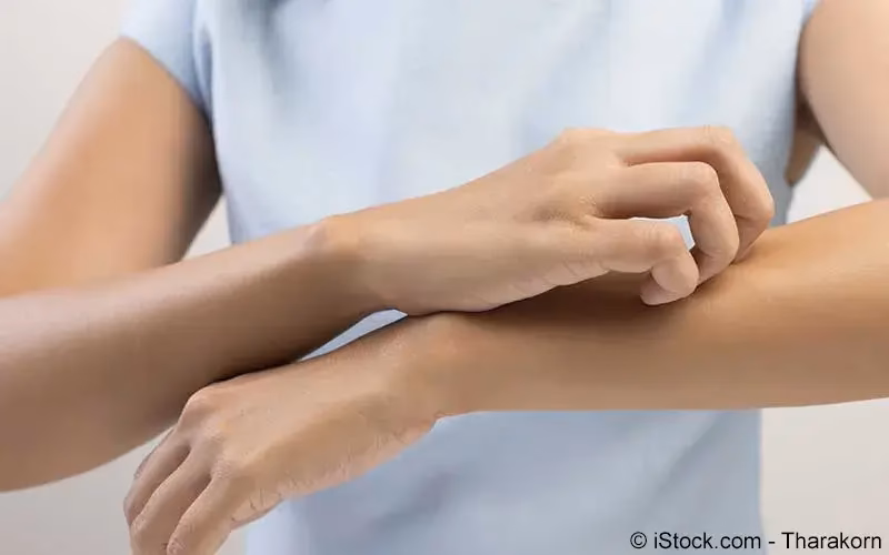 Was ist der Unterschied zwischen Glutamat und Mononatriumglutamat?