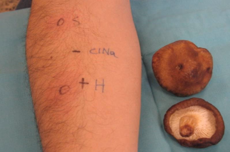 Does tiger milk mushroom extract reduce ovalbumin-induced airway inflammation?