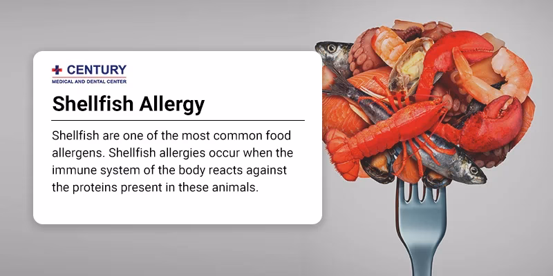 Should I go to the er If I have a shellfish allergy?