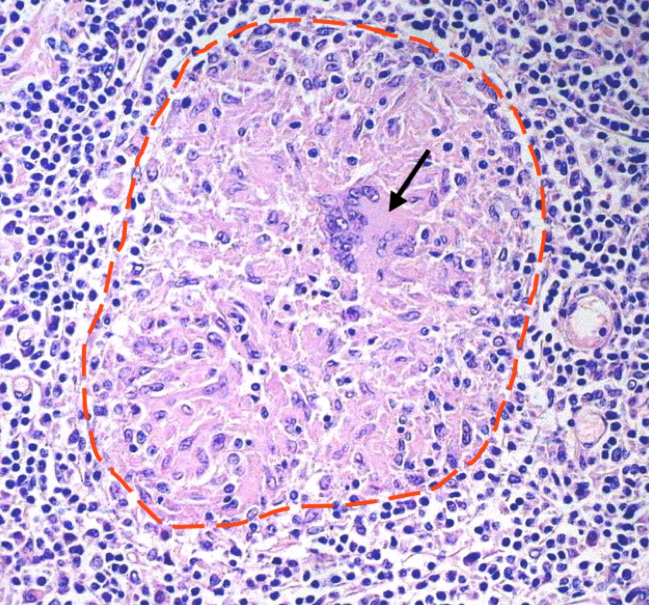 What Bacillus causes TB in humans?