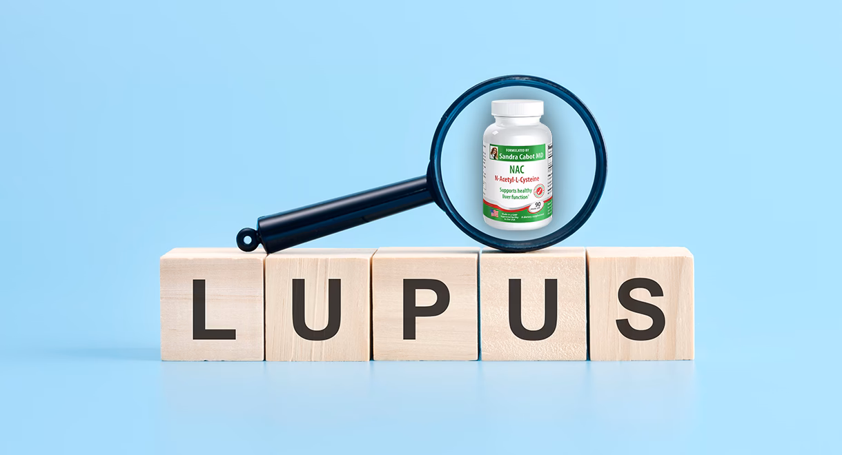 What are the treatment options for lupus?