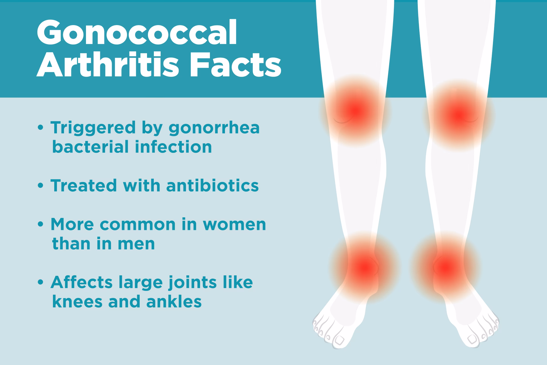 Can gonorrhoea cause arthritis?