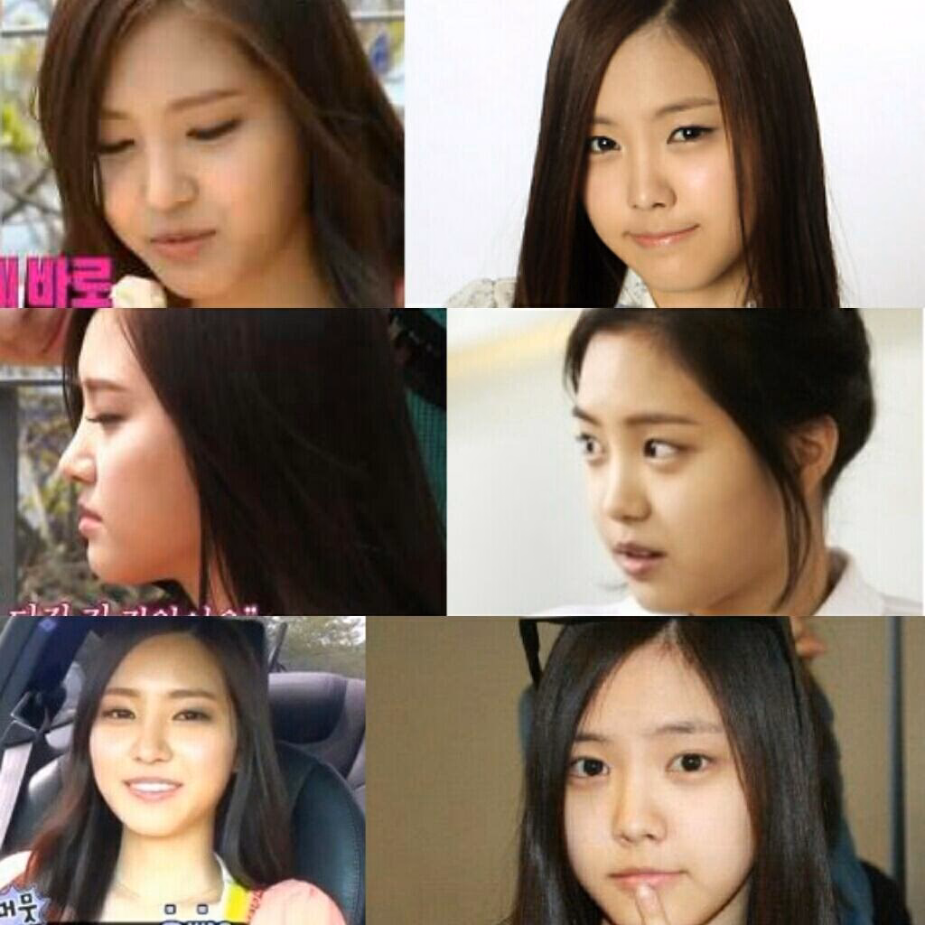Did Apink's Son Naeun get plastic surgery?