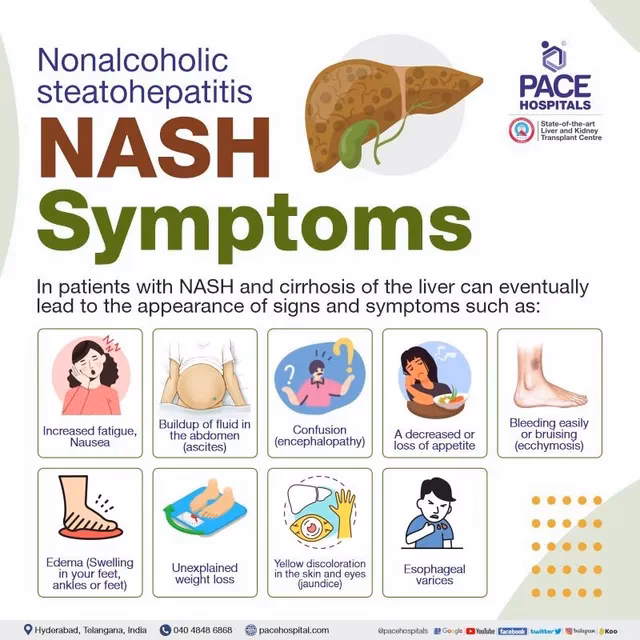 What is nonalcoholic liver disease (NASH)?