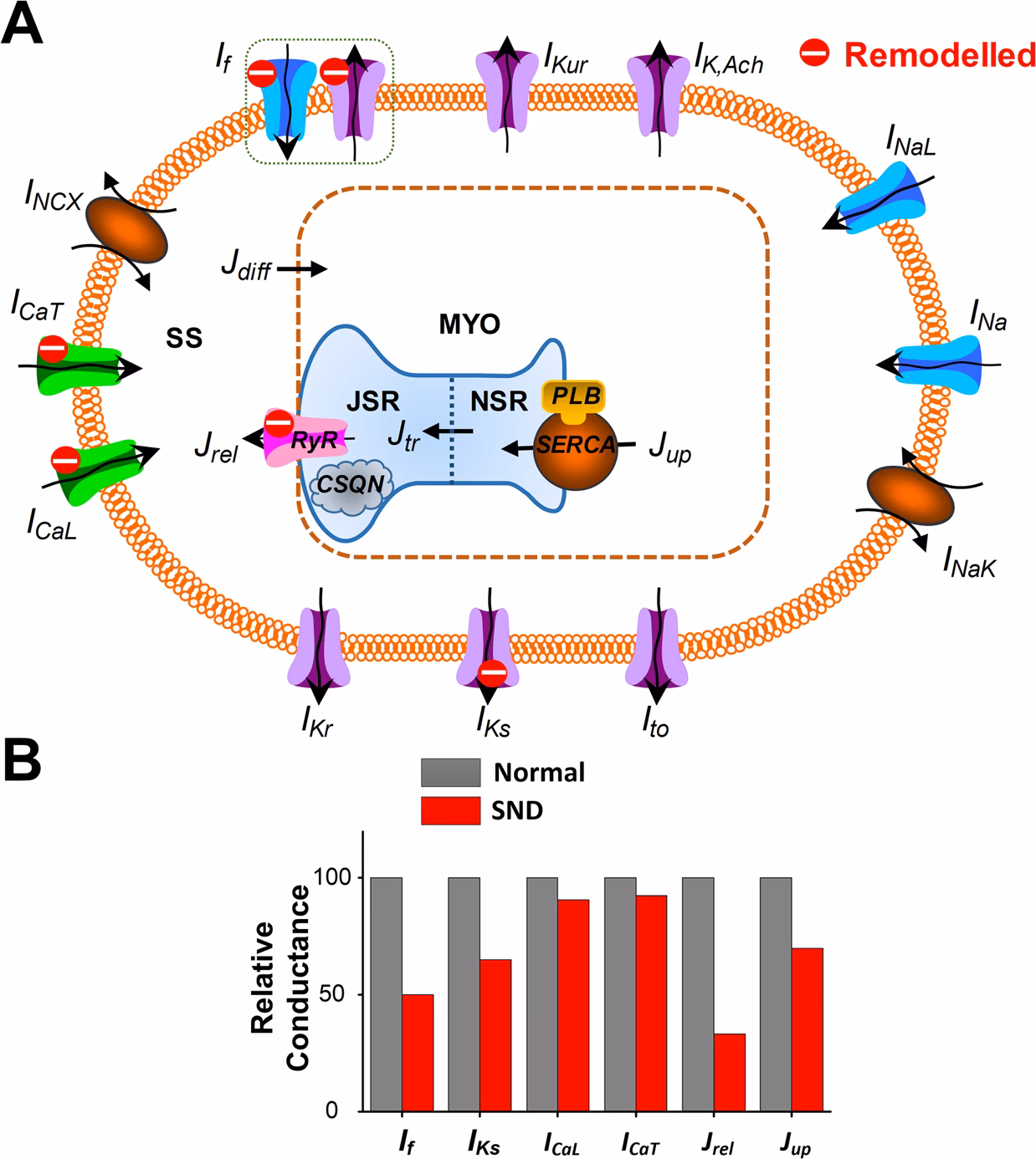 What is sinoauricular heart block?