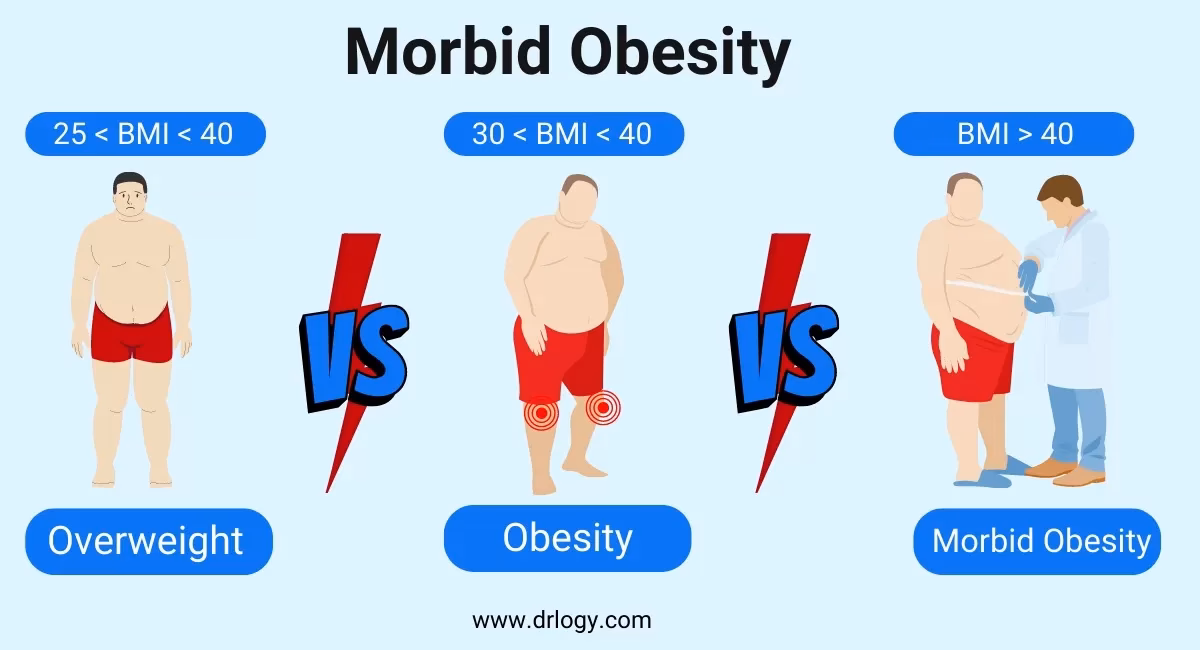 What is the full form of NBI?
