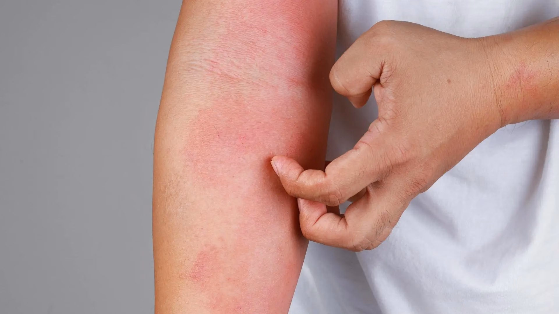 Was sind Antibiotika und Wie funktionieren sie?