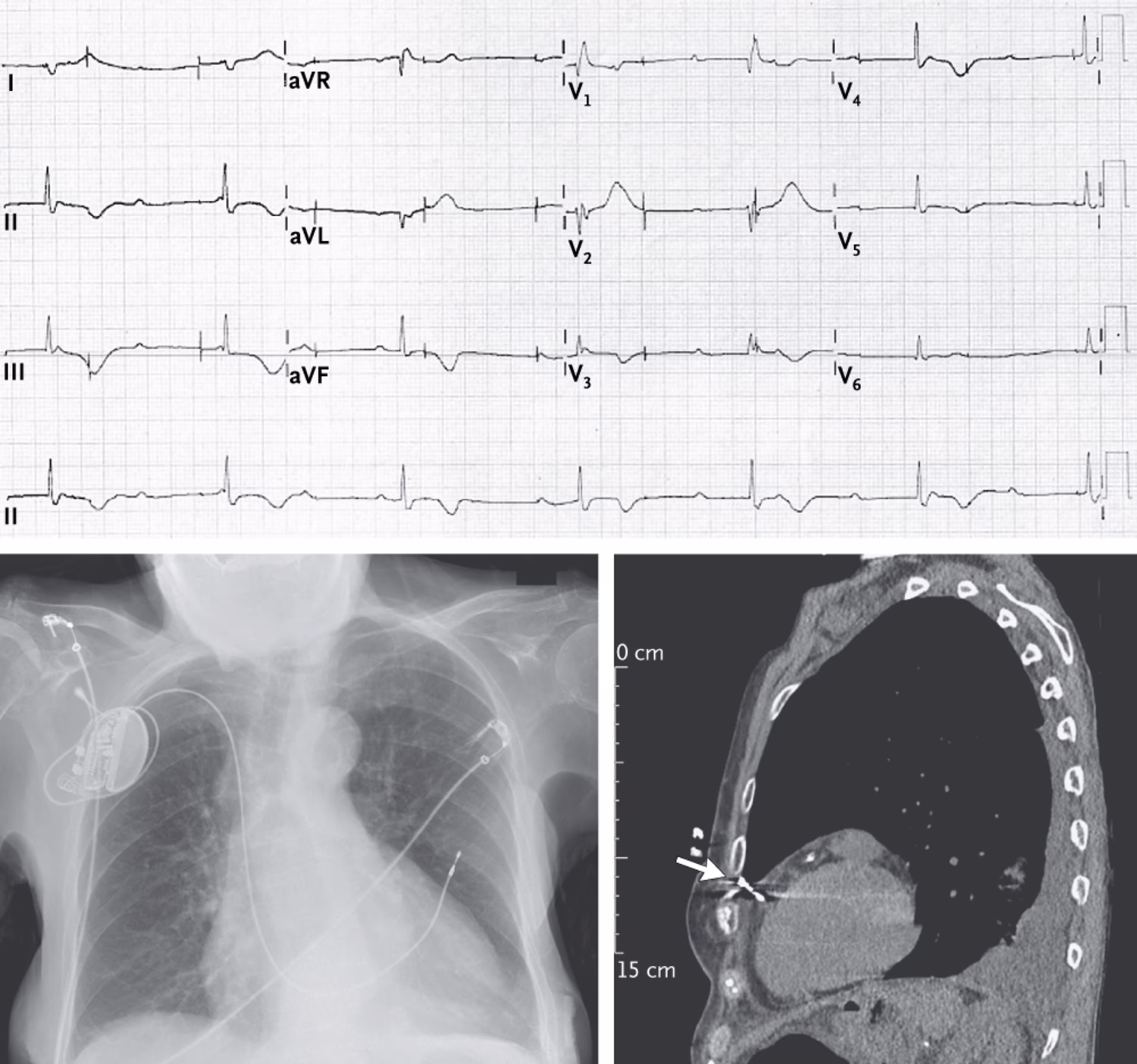 What does NEJM stand for?