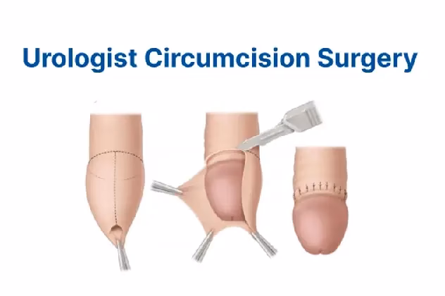 How much does an adult circumcision cost?