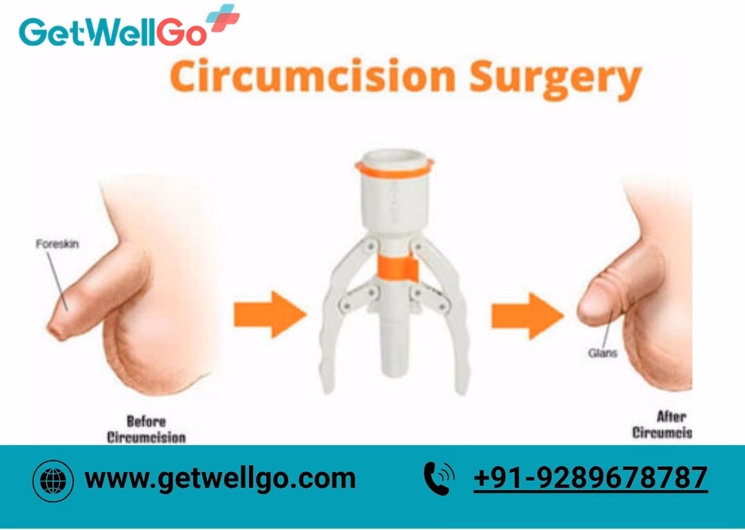 Does Cleveland Clinic offer foreskin restoration?