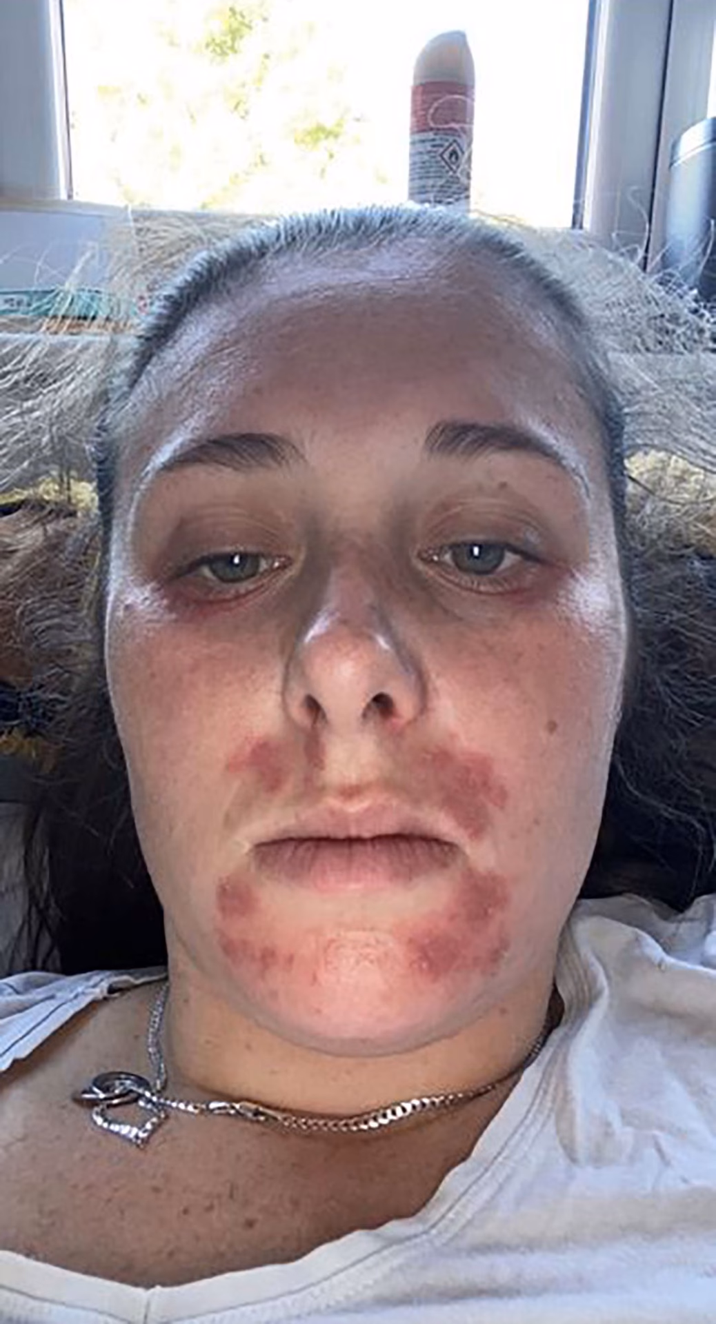 Can I vape If I have a nickel allergy?