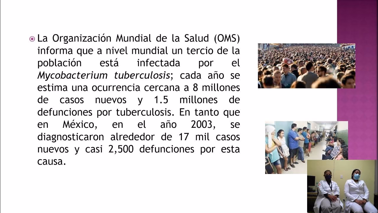 ¿Cuál es el segundo nivel de atención para el diagnóstico de tuberculosis?